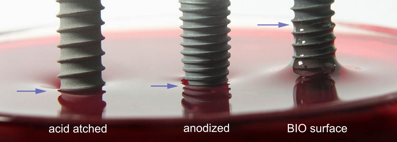 Comparaison de la mouillabilité des implants en titane à surface mordancée, anodisée et BIO