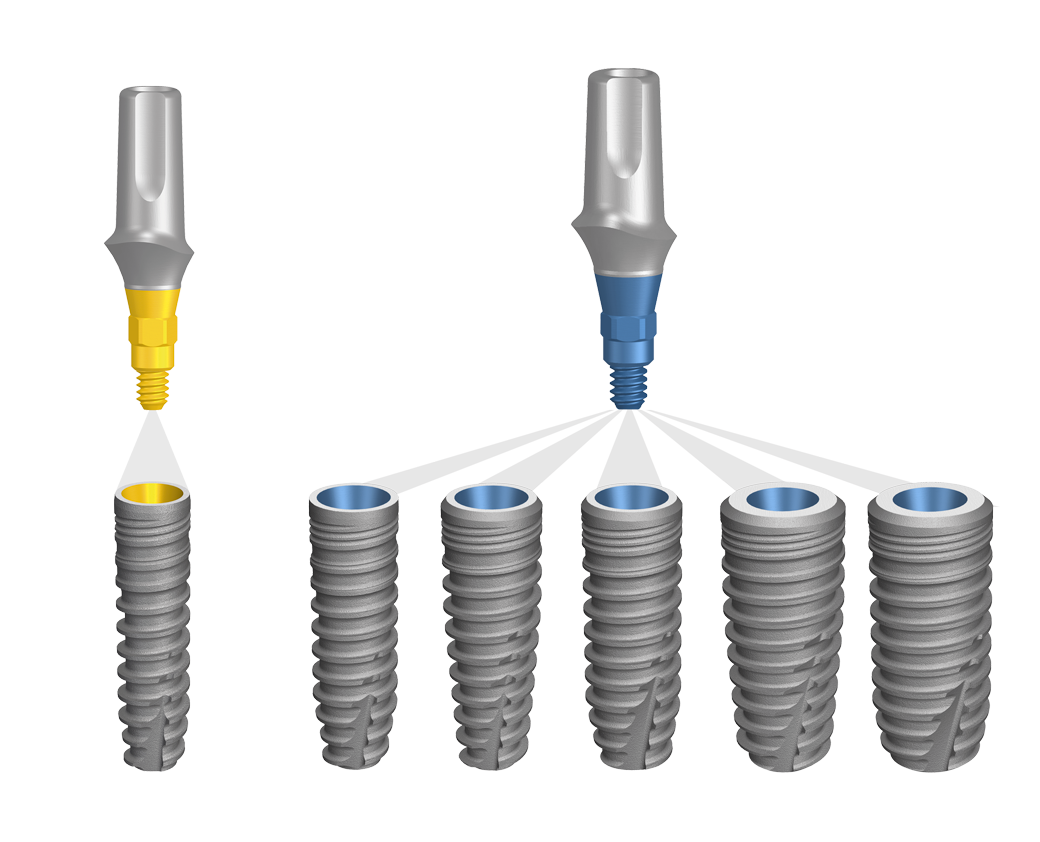 Composants prothétiques BioniQ pour des restaurations personnalisées