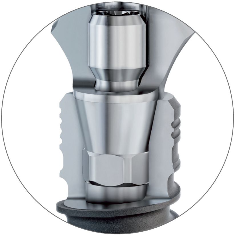 Coupe transversale de la connexion implant-pilier Q-Lock de BioniQ